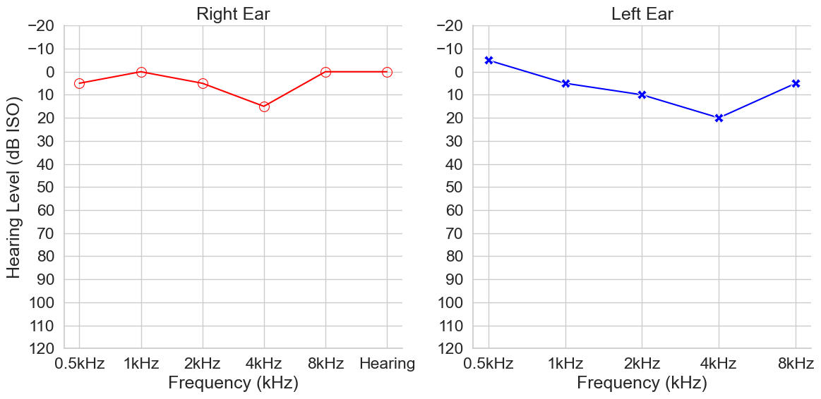 **Fig 2.** Example synthetic audiogram curve generate by model